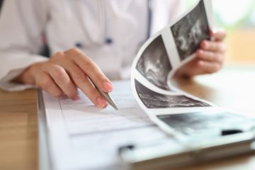 Mắc bệnh sùi mào gà sống được bao lâu